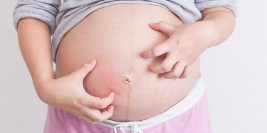 【おすすめアリ】妊娠中のよくある身体の悩みとお助けアイテム