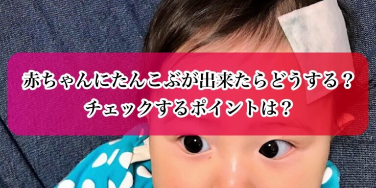 赤ちゃんにたんこぶが出来たらどうする チェックするポイントは パパママ Com